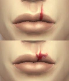 My Sims 4 Blog: Split Lip Scars by DecayClownSims Sims 4 Blog, Sims 4 Cas Mods, The Sims 4 Skin, Makeup Cc, My Sims, Sims 4 Mm Cc, Sims 4 Body Mods, Sims 4 Cc Skin, Sims 4 Cc Folder