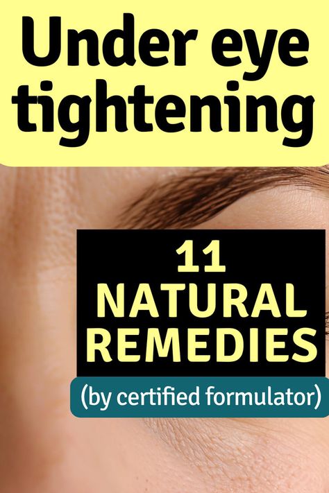 Image of a woman's face. Text reads: Under eye tightening. 11 natural remedies. By certified formulator. Tighten Under Eye Skin, Eye Bag Remedies, Eye Health Remedies, Puffy Eyes Remedy, Skin Care Home Remedies, Homemade Wrinkle Cream, Wrinkle Remedies, Skin Tightening Face, Under Eye Wrinkles