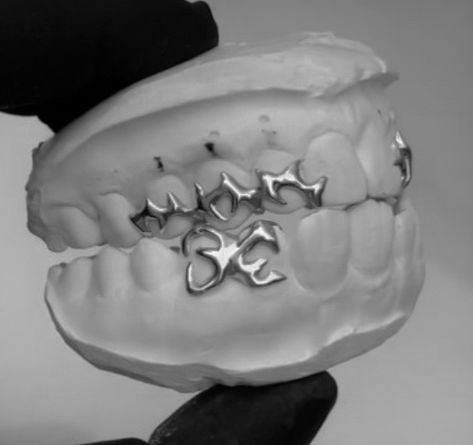 Silver Fang Grillz, Grill Design Teeth, Vampire Grillz, After Prom Outfit, Silver Tooth, Silver Grillz, Grillz Teeth, Tooth Gems, Prom Outfit