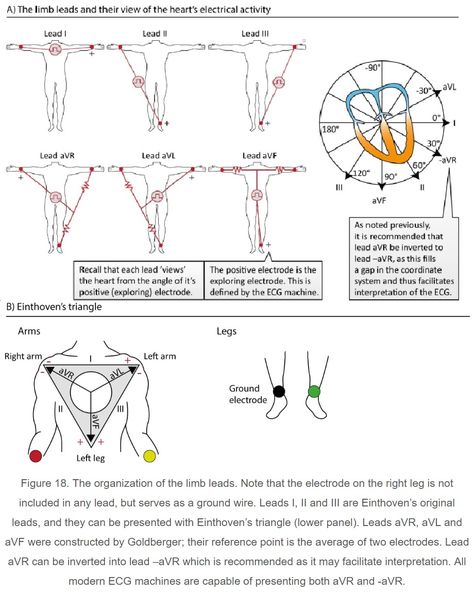 ECG Lead View Directions Cath Lab Nursing, Ekg Rhythms, Emt Study, Cardiac Sonography, Ekg Interpretation, Cardiac Cycle, Ecg Interpretation, Paramedic School, Nurse Study Notes