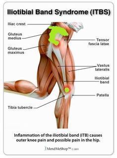 Tight It Band, Iliotibial Band, Runners Knee, Stability Exercises, Training Ideas, Musculoskeletal System, Muscle Anatomy, It Band, Knee Exercises