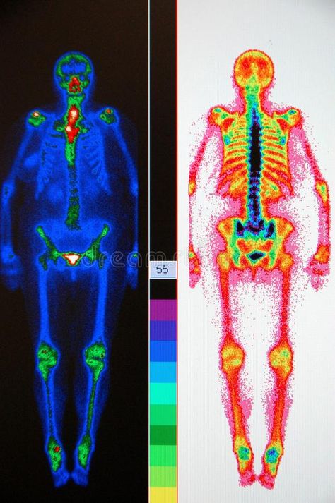 Nuclear Medicine Technologist Aesthetic, Nuclear Medicine Technologist, Nuclear Magnetic Resonance, Nuclear Technology, Body Scan, Pet Scan, Medical Student Motivation, Nuclear Medicine, Diagnostic Imaging