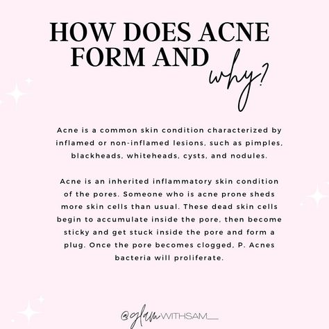 ACNE AWARENESS MONTH 🩷 For the month of June, I will be focusing a majority of my content on ACNE! I couldn’t be more excited to share my knowledge to help others clear their skin! I know from personal experience how hard it can be emotionally and physically to have acne. I’m here to help you manage your acne so you can be happy in your skin 🩷 REMINDER: Acne will not disappear overnight! Patience and consistency is key! With our without acne, you’re beautiful ⭐️😊 Skin Reminder, Acne Awareness Month, Acne Awareness, Month Of June, Consistency Is Key, Help Others, Helping Others, I Know, Acne