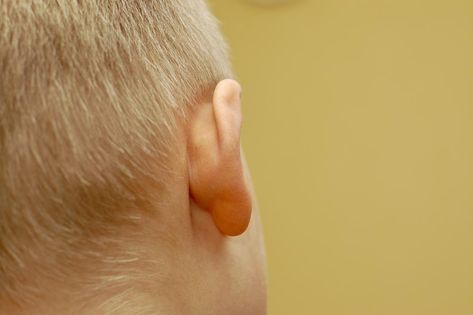 Lumps behind the ear: Causes and when to see a doctor Ear Pimple, Lump Behind Ear, Inflamed Pimple, Sternocleidomastoid Muscle, Cystic Pimple, Lymph Nodes, The Bump, Cystic Acne, The Ear