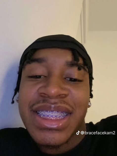 Red And Black Braces Combo, Purple Power Chain Braces, Purple And Blue Braces, Braces Colors Purple, Green Braces On Black People, Purple Braces For Black Women, Braces Colors Ideas Brown Skin, Black Braces Power Chain, Braces Dark Skin