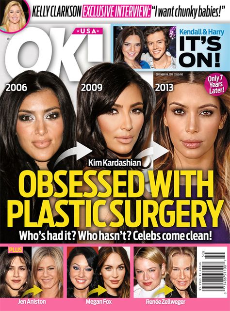 Kardashian Plastic Surgery, Extreme Plastic Surgery, Celebrity Surgery, Plastic Surgery Photos, Plastic Surgery Gone Wrong, Jen Aniston, Chunky Babies, Celebrity Plastic Surgery, Usa Baby