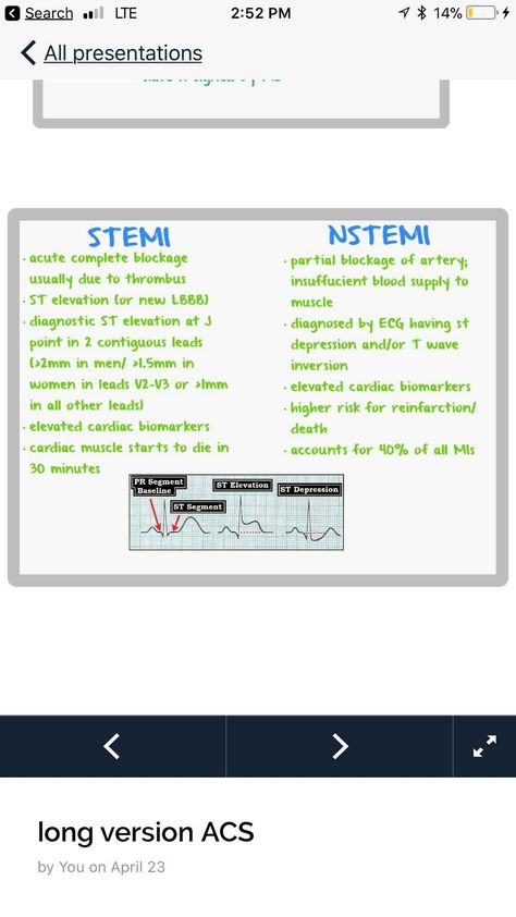 Cath Lab Education, Cardiac Cath Lab Nurse, Cardiac Cath Lab, Cath Lab Nursing, Cath Lab Nurse, Paramedic School, Nursing Information, Nursing Mnemonics, Cardiac Nursing