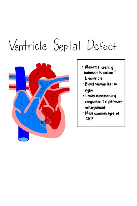 Pediatric Cardiac Nursing Congenital Heart Defect, Pediatric Heart Defects Nursing, Pediatric Sonography, Cardiac Pathology, Pediatric Cardiology, Peds Nursing, Ekg Rhythms, Heart Catheterization, Cardiac Anatomy