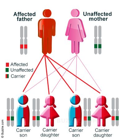 This is an example of dominate and recessive genes. Dominate genes stay and recessive genes don't show up. Sometimes pairs of genes from mom and dad mix and create a disorder. Diseases And Disorders, Biology Classroom, Genetic Diseases, Secondary Science, Ap Biology, Biology Lessons, Teaching Biology, Genetic Disorders, Science Biology