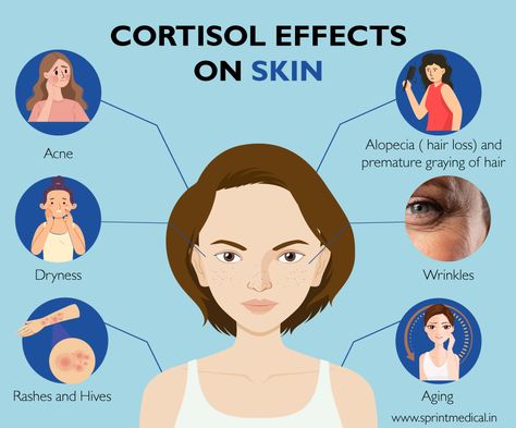 How stress affects the Skin? | Sprint Medical How To Get Rid Of Cortisol Face, Cortisol Face, Cortisol Lowering, Cortisol Imbalance, How To Lower Cortisol, 2024 Fitness, Spa Aesthetic, Lower Cortisol, Lower Cortisol Levels