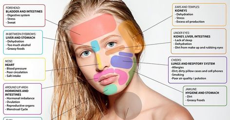 Face Mapping: What Pimples on your Skin tell about your Health Condition? Gesicht Mapping, Doterra Acne, Cheek Acne, Face Map, Chin Acne, Face Mapping Acne, Face Mapping, Natural Acne Remedies, Acne Causes