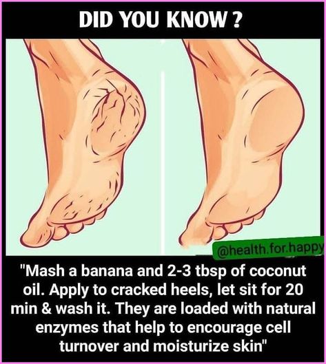 Healthy Skin Tips, Clear Healthy Skin, Natural Skin Care Remedies, Good Skin Tips, Beauty Tips For Glowing Skin, Natural Skin Care Routine, Beauty Remedies, Beauty Tips For Skin, Skin Care Solutions