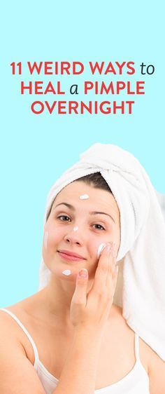 Warts On Face, Blind Pimple, Pimples Under The Skin, Ways To Heal, Acne Overnight, Pimples Overnight, Pimples Remedies, Skin Care Routine For 20s, Natural Acne Remedies