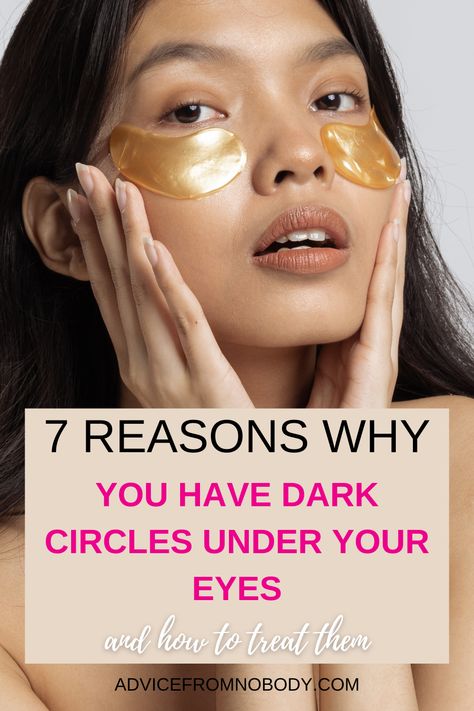 How to Get Rid of Eye Bags. If you want to know how to get rid of puffiness and dark circles under your eyes naturally (and instantly!), we're sharing 10 tips and tricks for fast, overnight relief! From skin care tips, to DIY remedies, to 3 makeup tutorials to teach you how to hide under eye bags with makeup, you don't want to miss this! While we can't promise to banish your dark under eye circles permanently, these beauty hacks definitely help! Hide Under Eye Bags, Black Undereye, Undereye Bags Remedy, Eye Bag Remedies, Get Rid Of Eye Bags, Rid Of Eye Bags, Dark Undereyes, Reduce Eye Bags, Dark Under Eye Circles