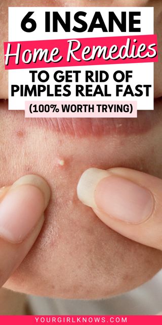 #pimples #acne #naturalremedies #skincare

Tired of dealing with pimples?

This blog post shares 5 natural ingredients that can help you get rid of pimples overnight.

These ingredients are all safe and gentle, so you can use them on your skin without worry.

Plus, they're all affordable and easy to find, so you can start using them today to clear up your Rid Of Pimples Overnight, Back Acne Remedies, Blind Pimple, Get Rid Of Pimples, Rid Of Pimples, Pimples Under The Skin, Forehead Acne, Pimples Overnight, Acne Overnight