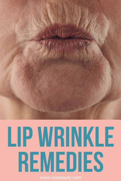 Are you dealing with upper lip wrinkles? You can counteract signs of aging and keep your skin soft and smooth at any age by using the upper lip wrinkle treatments on this list as your guide. Forget about those pesky lines and wrinkles around your mouth! #siobeauty #beautytips #skincare #skincareproducts #lipwrinkles #mouthwrinkles Wrinkles Around Lips, Makeup For Wrinkled Skin, Lip Wrinkles How To Get Rid Of, Wrinkly Lips, Frown Wrinkles, Eye Wrinkles Remedies, Wrinkles Around Mouth, Upper Lip Wrinkles, Chin Wrinkles