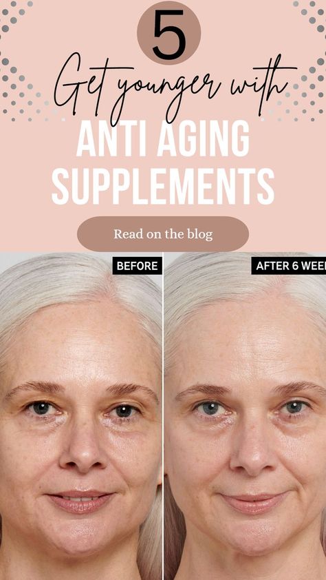 Look 20 younger with 5 best anti aging supplements for skin #antiwrinklecream #antiwrinkle #antiwrinkleserum #antiwrinkletreatments #antiagingskincare Antiwrinkles Cream, Supplements For Skin, Wrinkle Remedies, Tips For Oily Skin, Pimples On Face, Anti Wrinkle Treatments, Face Tips, Forehead Wrinkles, Anti Aging Supplements