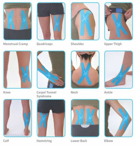 Kinesio Taping, Elbow Pain, Sports Tape, Kinesiology Taping, Knee Pain Relief, Athletic Training, Medical Knowledge, Trening Abs, Sports Medicine