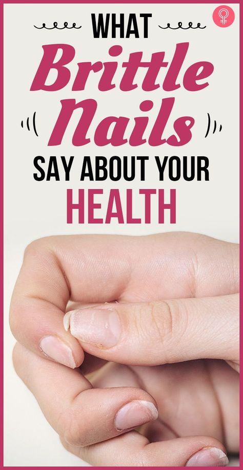 Nail Remedies, Nail Growth Tips, Grow Nails Faster, Weak Nails, Health Signs, Tongue Health, Brown Spots On Face, Nail Care Tips, Brittle Nails