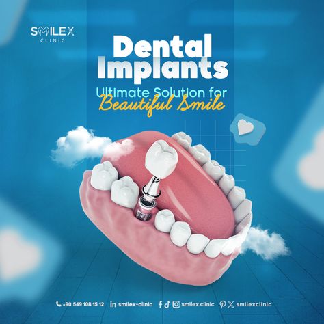 😊Say goodbye to gaps and hello to a beautiful smile with dental implants .  💪the ultimate solution for restoring your confidence!  💪 At SmileX, our experienced team ensures seamless integration and natural-looking results.  📞Reclaim your smile and schedule your implant consultation today!  ⚪ISTANBUL TÜRKÌYE  #orthodontics #straightteeth #veneers⁠ #tooth #dentalimplants #teethwhitening ⁠ #dentist #dental #dentistry #teeth⁠ #İstanbul #türkiye ⁠ Dentist Social Media Posts, Dentist Creative Ads, Dental Implants Creative Ads, Burger Ads, Dental Ads, Dental Advertising, Education Banner, Fire Horse, Tooth Design