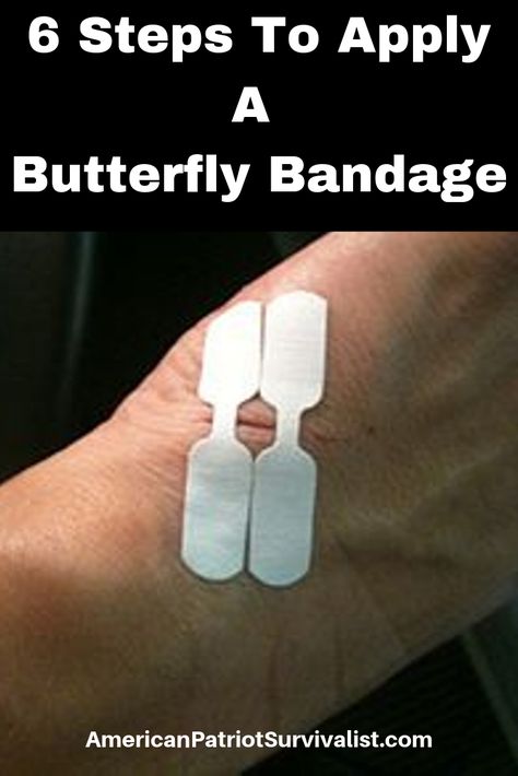 Do you have a butterfly bandage in your first aid kit?  Here are 6 steps on how to use a butterfly bandage (Don’t skip number 3) Butterfly Bandage, Suture Material, Shtf Survival, Aid Kit, Emergency Room, Survival Prepping, Training Equipment, Off Grid Living, First Aid Kit