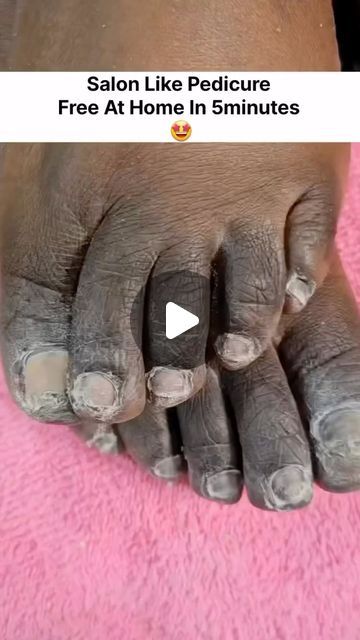 Bridal Pedicure, Acrylic Nail Designs Classy, Feet Nail Design, Diy Pedicure, Homemade Facial Mask, Face Skin Care Routine, Foot Pedicure, Diy Skin Care Routine, Beautiful Braided Hair