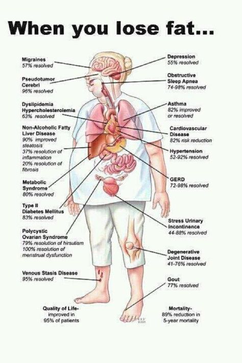 When you lose fat... Makanan Diet, Diet Keto, The Human Body, Health Info, Reduce Weight, Migraine, Get In Shape, Fitness Diet, Healthy Tips