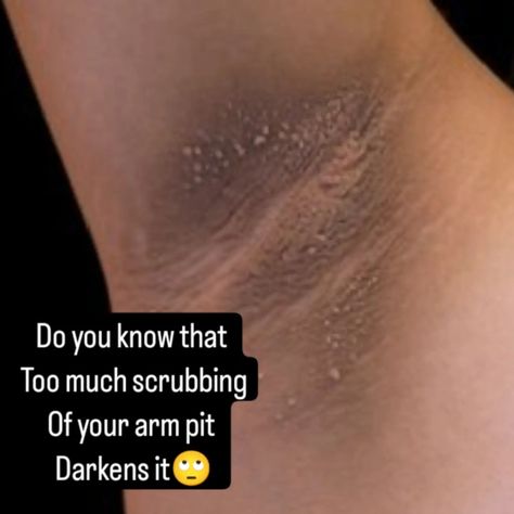 Sounds STRANGE right? Yes but this is the deal👇👇👇 Too much abrasion on any part of your skin will lead to skin darkening reasoning I do kick against using salt/ sugar scrub on the skin I still prefer chemical exfoliation anytime any day. Aside from using anti perspirant, scrubbing your arm pit with that hard sponge darkens your arm pit so STOP. Your water and soap with soft sponge or towel will definitely clean up that area!!! And you won't smell. Your skin renews itself without your aid ... Skin Darkening, Chemical Exfoliation, Anti Perspirant, Yes But, The Deal, Sugar Scrub, Clean Up, Too Much, The Skin