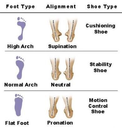 Does foot type, like high or flat arches, and over pronation impact injury rates? What about shoe type - traditional shoes versus minimalist shoes? This site examines the research on the impact of footwear and foot type on injury Back Pain, Shoes For High Arches, Best Nursing Shoes, Minimalist Shoes, Nursing Shoes, Poor Posture, Foot Health, Foot Pain, Injury Prevention