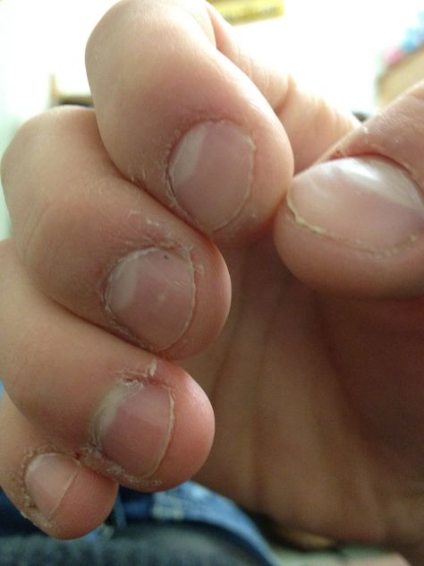 Tips to help stop nail biting Nail Biting Remedies, Nail Growth Remedies, Stop Nail Biting, Nail Biting Habit, Mirror Nail Polish, Gel Nails At Home, Mirror Nails, Nail Care Tips, Nail Biting