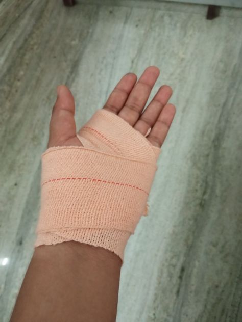 Fracture Hand Plaster Girl, Nas Kata Hua Hand Pic Real, Hand Instagram Story Ideas, Hand Plaster Fracture Snap, Fake Accident Snap Bike, Bandage On Hand Photo, Hand Bandages Fake Story, Accident Snap Ideas Hand, Hand Fracture Snap