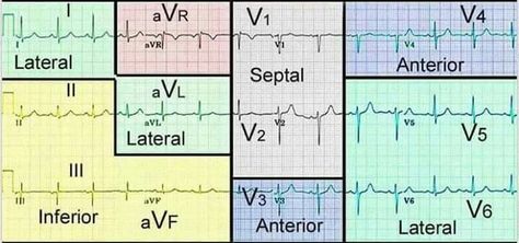 12 lead views Ekg Interpretation, Ecg Interpretation, Paramedic School, Nursing Mnemonics, Cardiac Nursing, Critical Care Nursing, Nursing School Studying, Nursing School Tips, Nursing School Notes