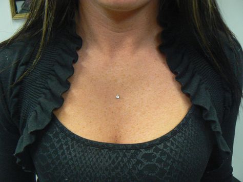 Piercing Chest Dermal, Chest Piercing Dermal, Dermal Piercing Petto, Chest Dermal Piercing Center, Surface Piercing Chest, Chest Piercings For Women, Chest Dermal Piercing, Neck Dermal, Piercing Chest