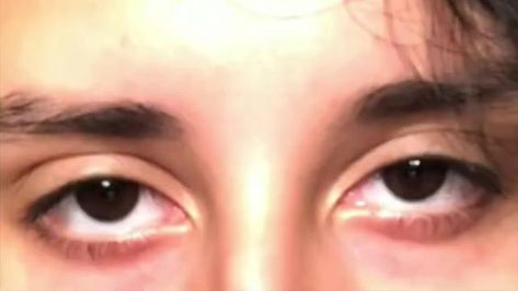 Demonic eyes ,sunpaku eyes Eye Claims For Dr Male, Eyes Looking At You, Downturned Eyes Reference, Sanpaku Eyes Men, Tired Eyes Men, Downturned Eyes Men, Sleepy Eyes Men, Tired Eyes Draw, Insane Eyes Reference