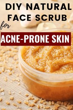 Diy Face Scrubs For Acne, All Natural Face Scrub, Diy Body Scrub For Acne, Homemade Acne Scrub, Acne Soap Diy, Natural Face Scrub For Acne, Best Facial For Acne, Facial Scrubs Diy Exfoliating For Acne, Diy Acne Face Scrub