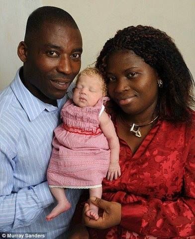 Angela Ihegboro Is From Nigeria Who Gave Birth To Baby Nmachi Who Is White And Blond Headed. All civilization started from the very 2 people Jehovah God created and placed them in the Garden Of Eden. Medical Anomalies, Physical Anthropology, African Room, Caucasian Race, Human Genetics, Genesis 25, Richard Johnson, Ancient World History, Blue Eyed Baby