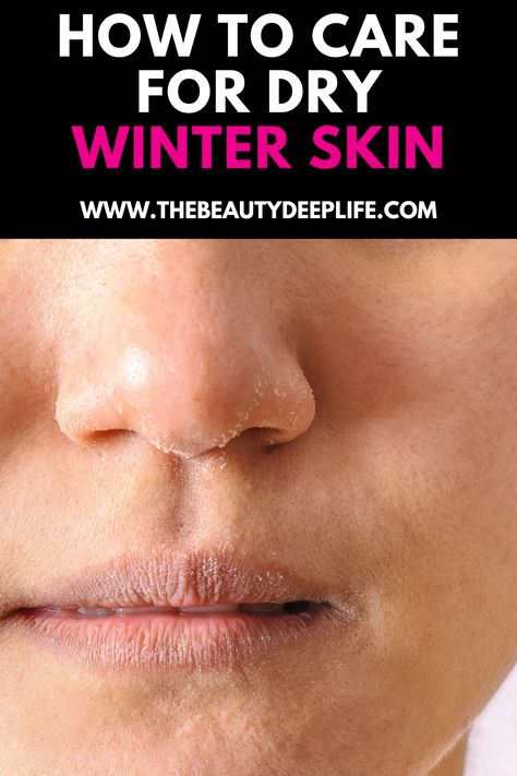 Learn how to prevent, treat, and care for your dry winter skin! Dry Winter Skin Face, Dry Nose Skin, Dry Face Remedy, Flaky Skin On Face, Facial For Dry Skin, Super Dry Skin, Winter Skin Care Routine, Winter Skincare, Extremely Dry Skin