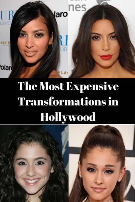 The Most Expensive Transformations In Hollywood Hollywood Beautiful Celebrities, Celebrities With Veneers, Plastic Surgery Fail, Models Without Makeup, Beauty Transformation, Plastic Surgery Gone Wrong, Transformation Pictures, Celebs Without Makeup, Facial Fillers