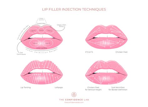 Lip Injections Shapes, Botox Business, Botox Quotes, Aesthetic Injector, Facial Injections, Aesthetic Nursing, Medi Spa, Aesthetic Dermatology, Nurse Injector