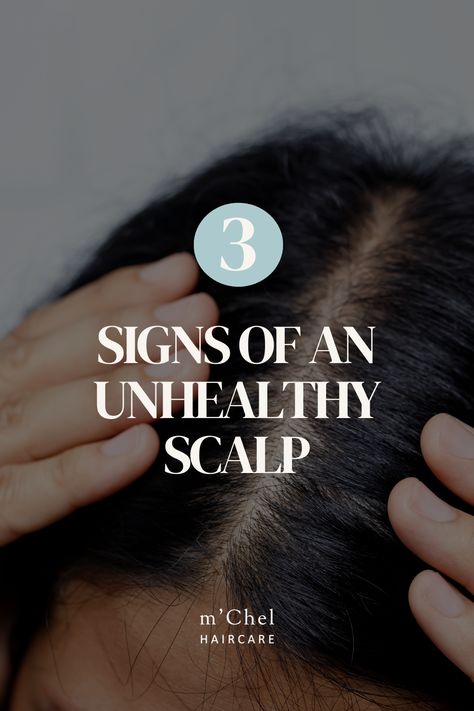 Healthy, luscious hair begins with a well-maintained scalp. Often overlooked, scalp health significantly impacts the appearance and vitality of your locks. Issues like itchiness and excessive oiliness can signal scalp problems. In this blog post, we'll discuss three signs of an unhealthy scalp and provide three solutions to restore balance. Plus, we'll explain why replacing aerosol dry shampoo with 'The Day After Brush', our 2-in-1 powder dry shampoo is a game-changer for scalp and hair health. Scalp Health Tips, Unhealthy Scalp, Powder Dry Shampoo, Scalp Cleanse, Scalp Problems, Haircare Tips, Scalp Brushing, Hair Issues, Luscious Hair