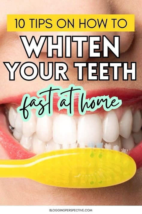 Discover the best way to whiten teeth at home and learn how to get white teeth quickly with our expert tips. From natural methods to easy DIYs, find out the top teeth whitening remedies that will give you beautiful teeth without the wait. Don't miss out on these transformative white teeth tips at home. Click to explore the full list of teeth whitening at home strategies! Homemade Teeth Whitening, White Teeth Tips, Whiten Teeth Naturally, Make Teeth Whiter, Whiten Teeth At Home, Diy Teeth Whitening, Whiten Teeth Fast, Natural Teeth Whitening Diy, Baking Soda Teeth