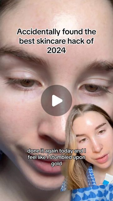 Natalie O’Neill on Instagram: "Sebaceous filaments be gone ✨ I filmed this on the same day that I posted the original 🎀 #sebaceousfilaments #blackheads" How To Get Rid Of Sebaceous Filaments, Sebaceous Filaments Removal, Sebaceous Filaments Skincare, What To Apply First Skincare, How To Prevent Blackheads, Skincare Problems, Blackheads On Face, Beauty Education, Sebaceous Filaments