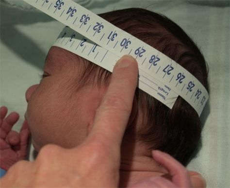 Head Circumference Nursing Assessment, Ob Nursing, Pharmacology Nursing, Normal Weight, Nurse Rock, Newborn Nursery, Nursing Tips, Nursing Baby, Nicu Nurse