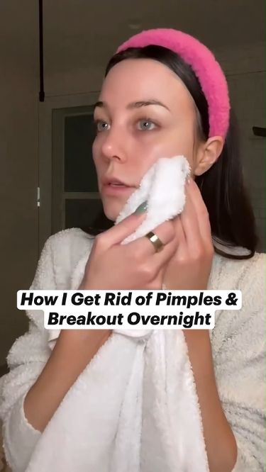 Pimple Pain Vanquished: Dermatologist-Approved Healing Tactics #beauty #beautyhacks #pimple #acne, #pimples #overnightpimples #removepimples #removepimplesovernight https://whispers-in-the-wind.com/combatting-pimples-under-the-skin-expert-tips-and-product-recommendations/?195 Remove Pimples Overnight, Painful Pimple, Different Types Of Acne, Get Rid Of Pimples, Rid Of Pimples, Stubborn Acne, Pimples Under The Skin, Fresh Aloe Vera Gel, Pimples Remedies