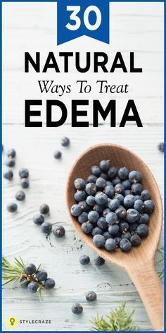 Swollen ankles and feet, puffy eyes and a general feeling of heaviness — yes, you may have edema. Edema, in simpler terms, is water retention. Water tends to accumulate between cells in your soft tissue and can occur due to many conditions. Here are 30 effective home remedies to treat edema. #HomeRemedies #UTI #remedies #natural #healing Swollen Feet Remedies, Autogenic Training, Water Retention Remedies, Feet Remedies, Swollen Ankles, Healthy Diet Tips, Water Retention, Healthy Food Choices, Good Health Tips