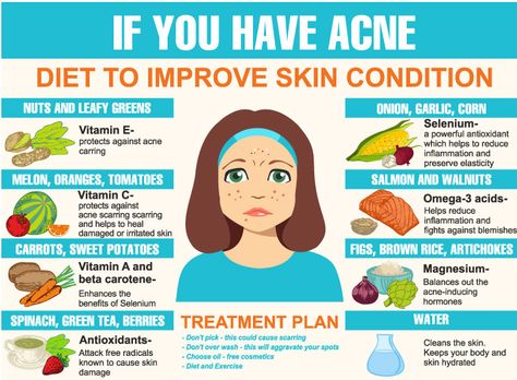 Holistic Tips, Clear Skin Fast, Acne Diet, Skin Care Routine For 20s, Vitamin C Benefits, Clear Skin Tips, Skin Condition, Vitamins For Skin, Acne Remedies