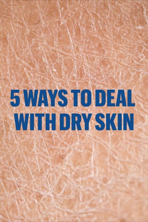 How To Remove Dryness From Face, Winter Dry Skin Care, What To Do For Dry Skin, Dry Skin Remedies For Body Winter, How To Remove Dry Skin From Face, Best Soap For Dry Skin, Dryness On Face, Dead Skin On Face, Dry Flaky Skin On Face