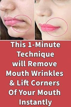 Wrinkles Remedies Face, Home Remedies For Wrinkles, Obličejové Masky, Mouth Wrinkles, Wrinkle Remedies, Wrinkle Free Skin, Lip Wrinkles, Face Exercises, Skin Care Wrinkles