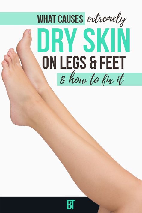 Extremely dry, itchy skin can be a problem! Check what can be the causes and how to treat dry skin on legs and feet. Legs Skin Care, Dry Skin Legs, Dry Peeling Skin, Itchy Skin Remedy, Dry Legs, Dry Skin Problem, Extremely Dry Skin, Dry Flaky Skin, Dry Skin Remedies