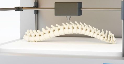 3d Printing Medical, Human Spine, Medical Device, Day Work, Clothes Hanger, Perfect Match, The Future, 3d Printing, 3 D